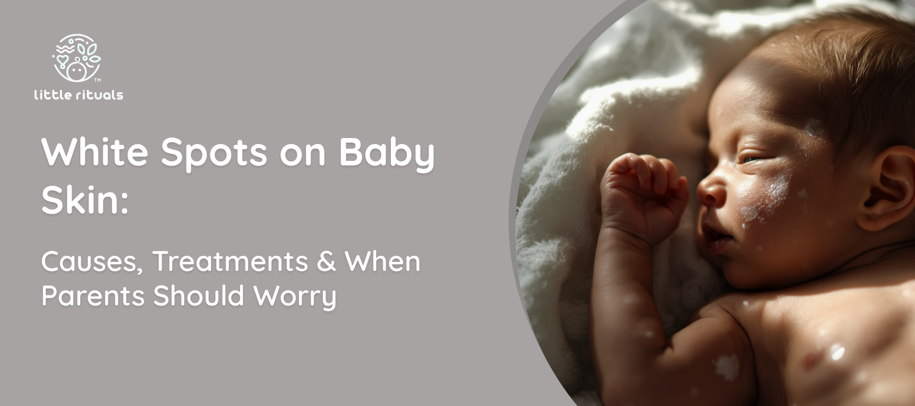 white spots on baby skin