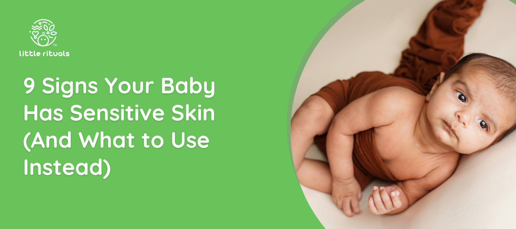 signs-of-sensitive-skin-in-babies