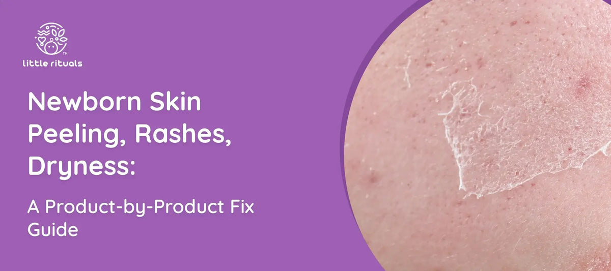 Newborn Skin Peeling, Rashes, Dryness: A Product-by-Product Fix Guide