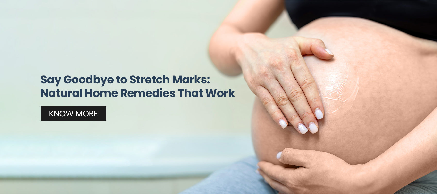 Say Goodbye to Stretch Marks: Natural Home Remedies That Work