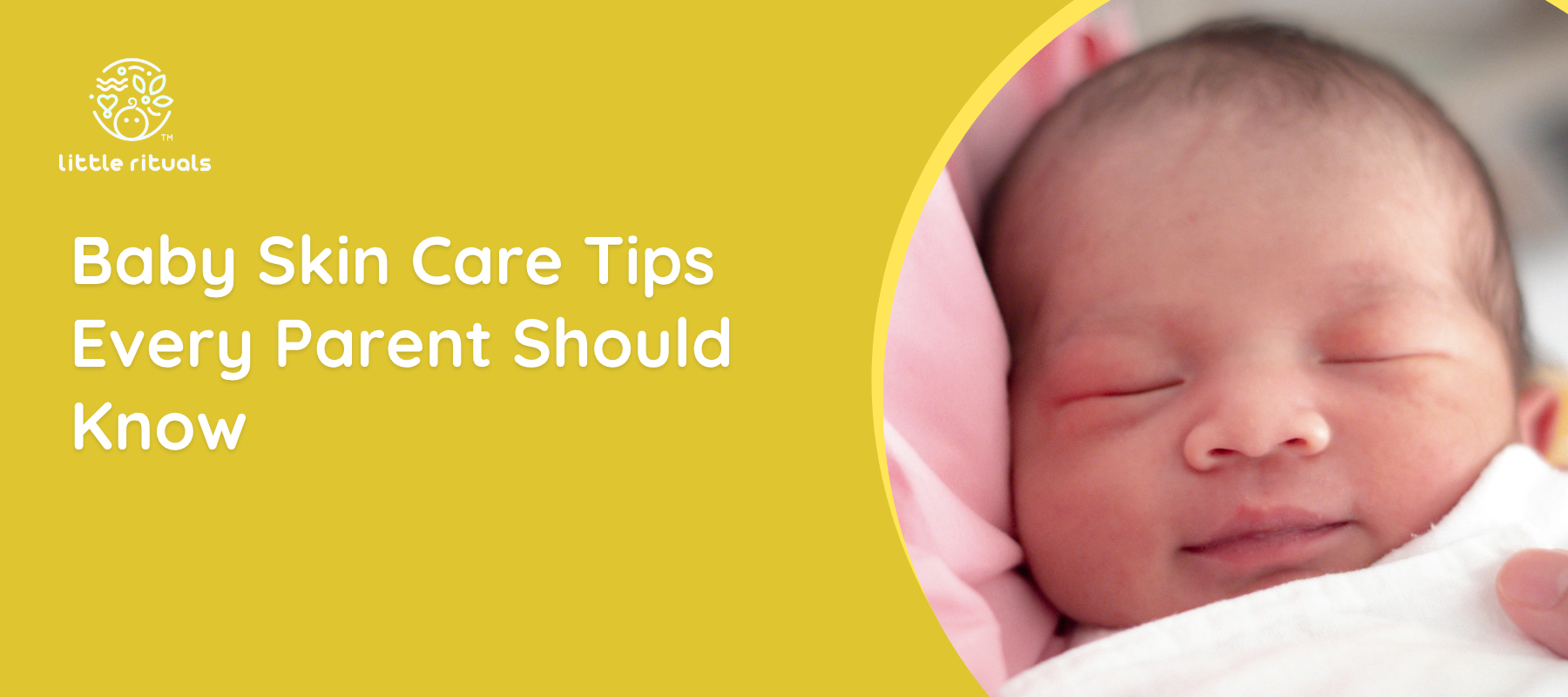 baby skin care tips