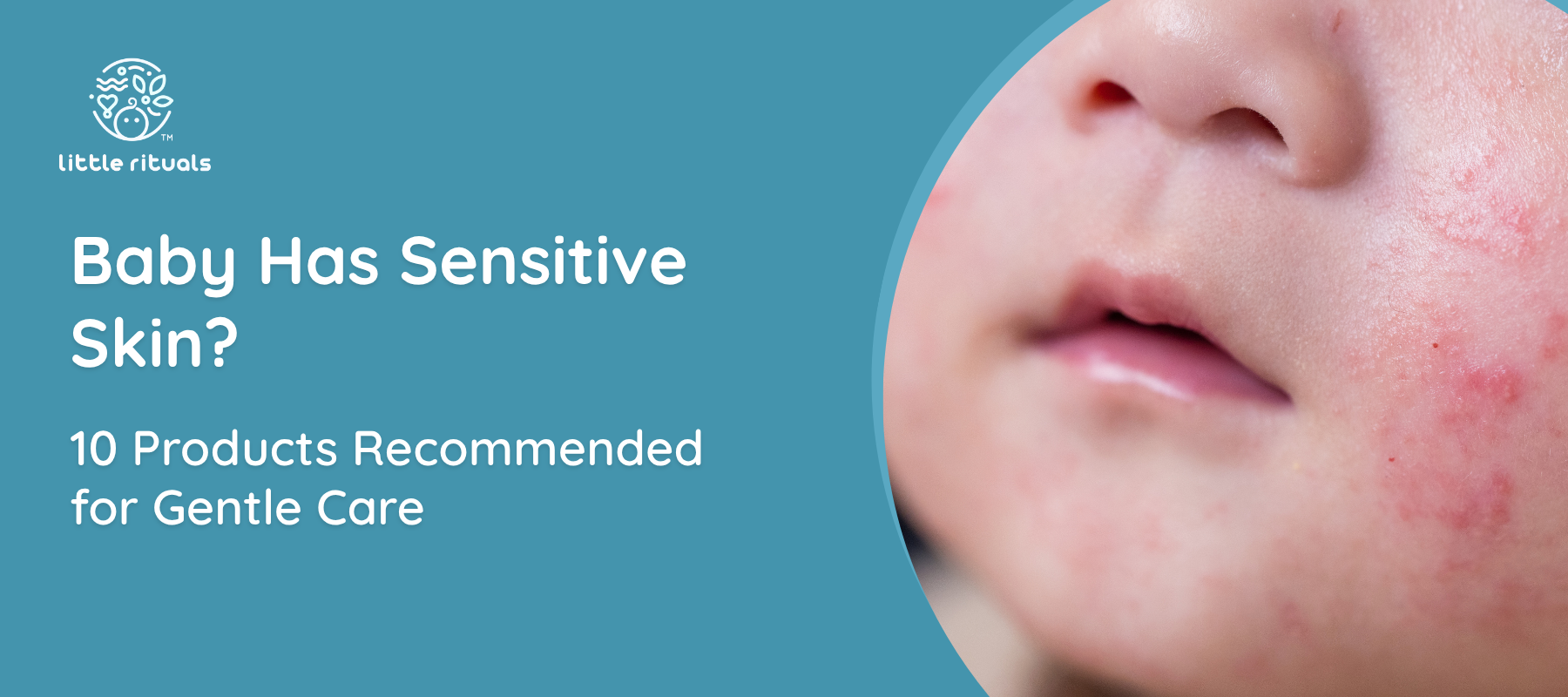 Baby Has Sensitive Skin? 10 Products Recommended for Gentle Care