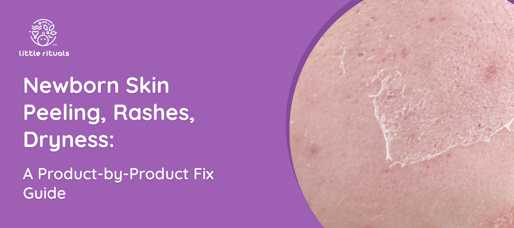 Newborn Skin Peeling, Rashes, Dryness: A Product-by-Product Fix Guide