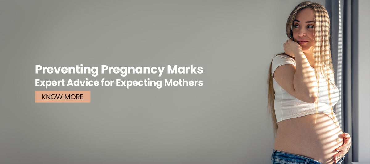 Preventing Pregnancy Marks: Expert Advice for Expecting Mothers